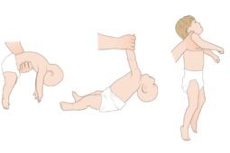 Hipotonia muscular postura